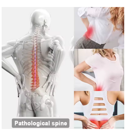 Back Stretcher Pro™