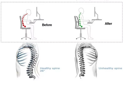Back Stretcher Pro™